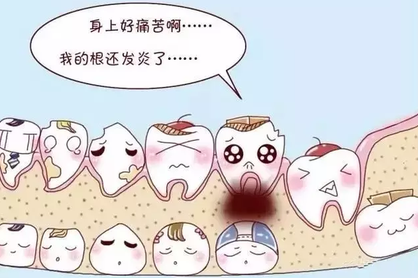 六种情况智齿该拔