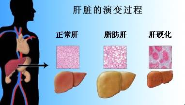 什么情况会得乙肝病毒 1c54d82f8acb4b2badf7407932afa4e2.jpeg