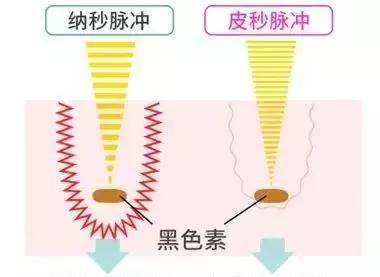 激光是怎么样形成的 7eef64c4ebc94a8e89a02b7260056c6a.jpeg
