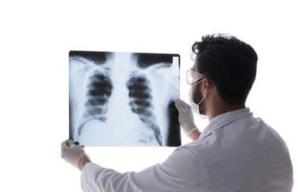 47岁男子,查出肺癌,身体出现1粗,2黑,3痛,及时查肺