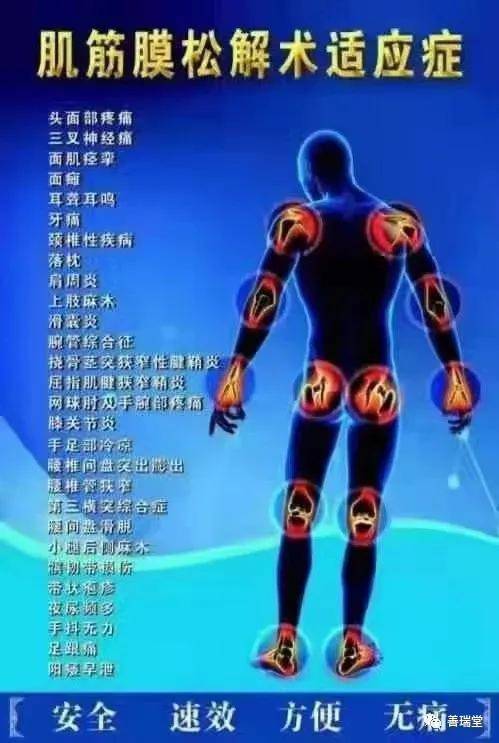 肌筋膜松解术的治疗优势