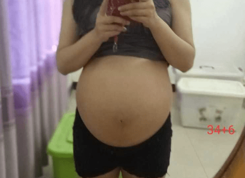 nt■为何会查出胎儿畸形？孕妈妈应该了解nt查出胎儿唇裂
