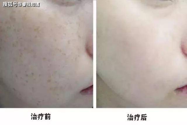 c88033fb1d3f4a9bb53904ca81a750c5.JPG