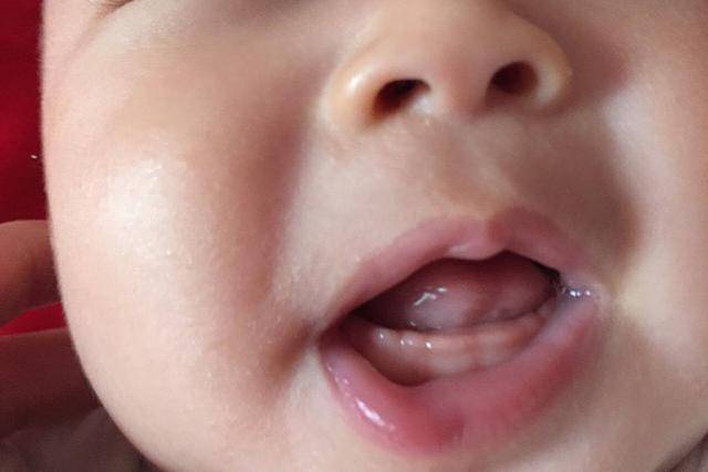「牙齿」不仅影响健康还影响颜值，怎么做到“一口好牙”？孩子牙齿好坏