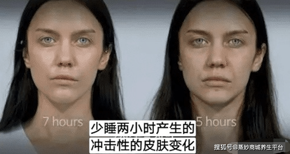 朋友圈扎心自拍别熬夜了你会越来越丑