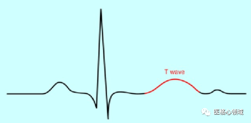 正常心电图波形及临床意义_心室