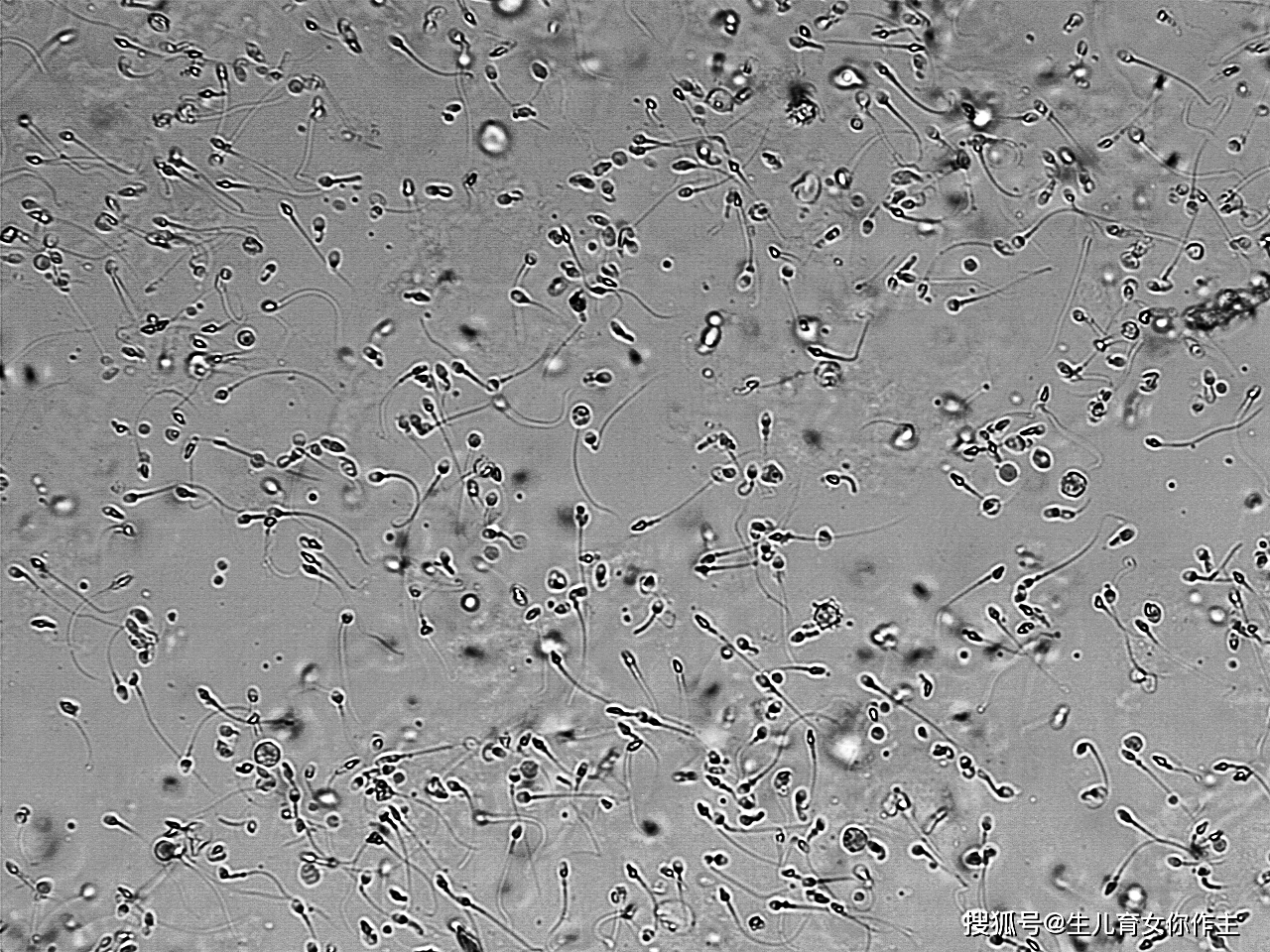 显微镜下的精子(图片来自网络)