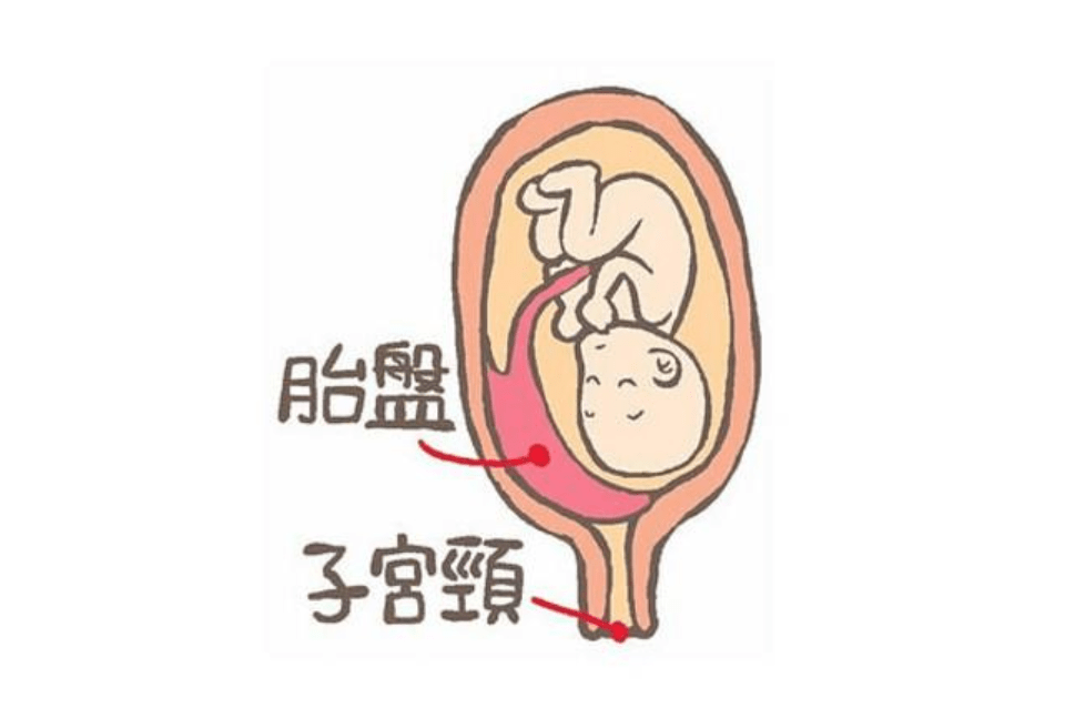 孕妈要注意！孕期出现这6种迹象，可能胎儿发育异常，别不当回事阿朵当街喂奶