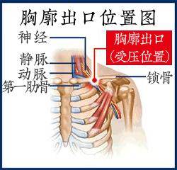 锁骨太过饱满,摸起来还很硬?很可能是你这长了肿瘤