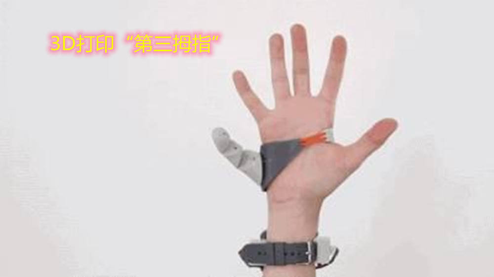 双脚|15人双手双脚皆六指，网友：结婚戒指戴哪巴西“六指琴魔”家族