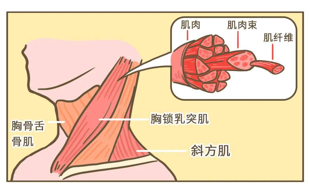 落枕,是脖子在喊救命_肌肉