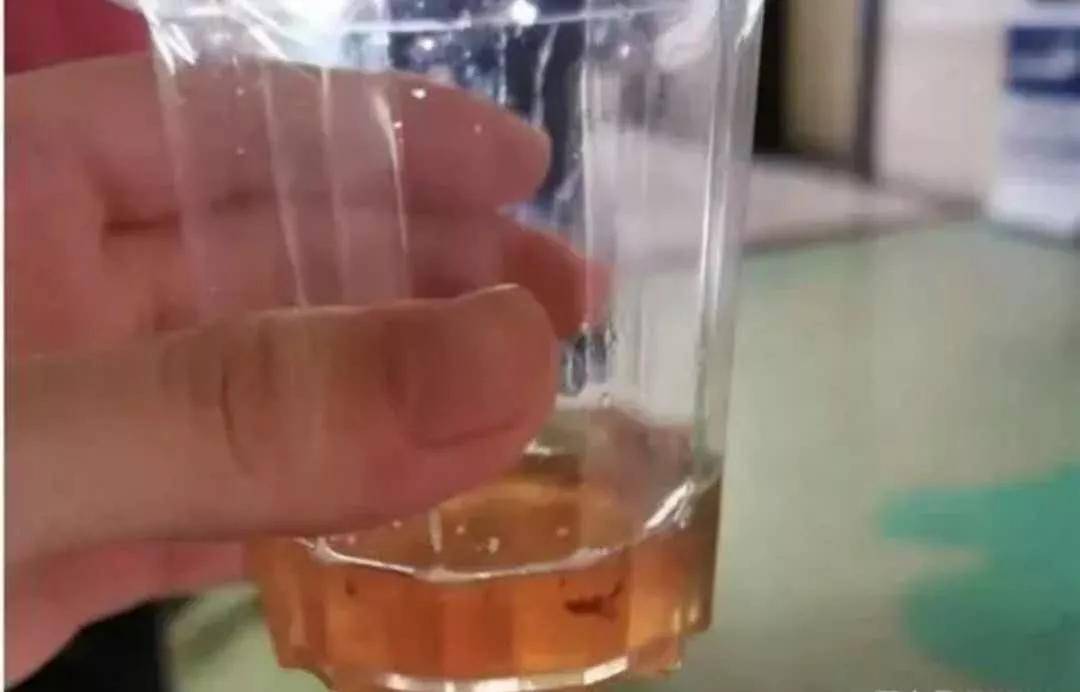 消化道|孩子消化道出血！这种“好东西”，千万别给孩子吃!一口“神仙水”