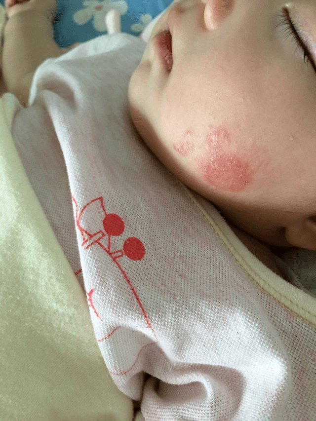 孩子|要警惕这种疾病，多半宝宝会夜间哭闹宝宝出生前三个月