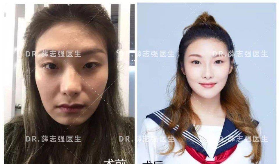 发现自己左右脸不对称,该怎么办啊?