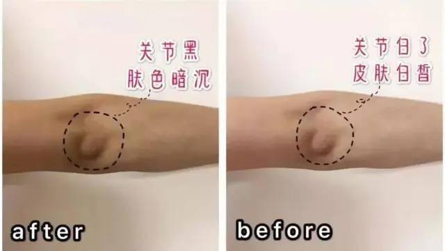 安利 6招拯救手肘,膝盖黑疙瘩,简直夏季必备,谁用谁好看
