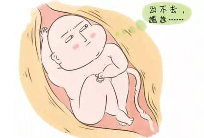 巨大儿能顺产吗？顺产8斤女儿，聊聊我的经历