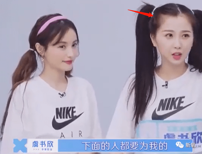 虞书欣不是才24岁吗?怎么就秃成这样了…