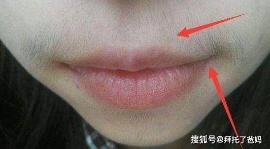 胡须|医生：这些食物不要再给孩子吃了，家长别心大15岁女孩长出胡须