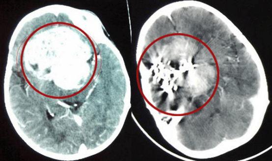 中国有质子刀 1ff0627b84ac41cf8c6982ce5a988428.png