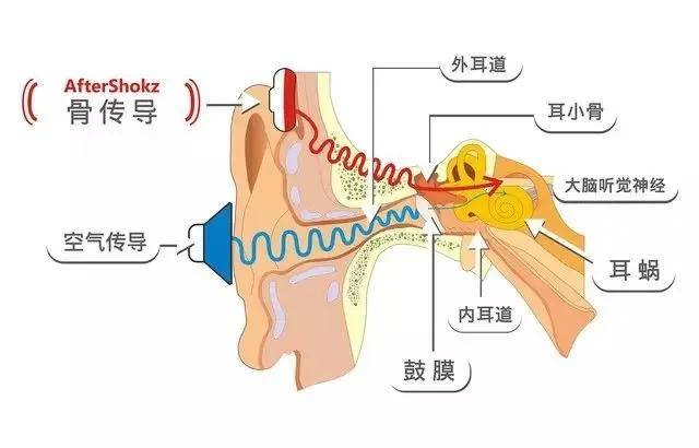 怎么能让自己快速戴上耳蜗 5b19136a97d943a78baabc29dd26768b.jpeg