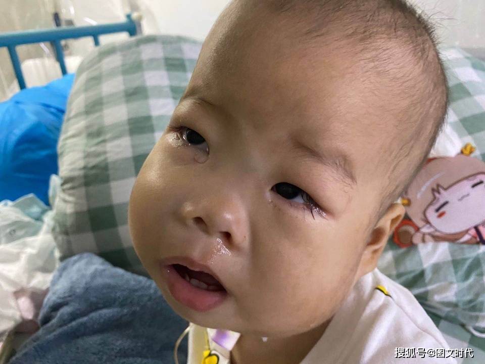 肿瘤|最终查出罕见肿瘤，妈妈：我只想让他活着1岁男童鼻子流血不止