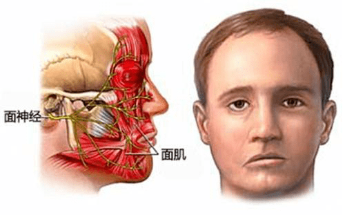 神经内科空调吹出面瘫是时候学习这套脸保健操了