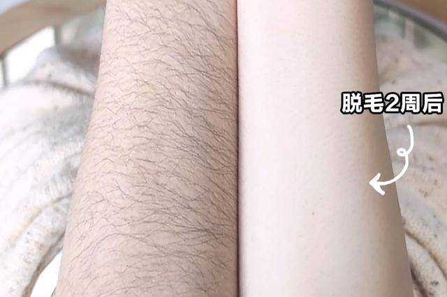 用起来一点也不刺激,敏感肌也可用,效果也非常好,就算是腋下的顽固
