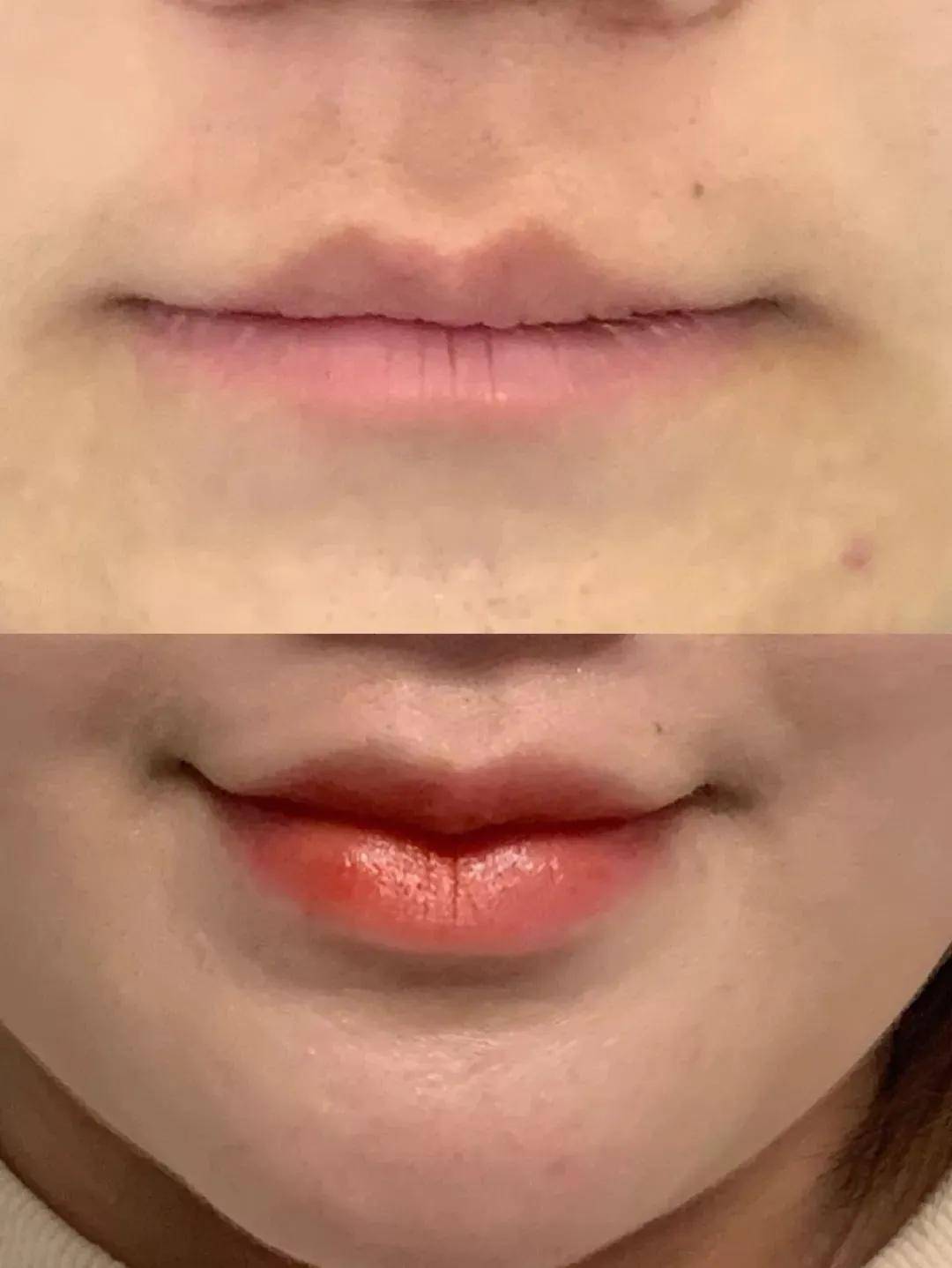 怎么样才可以让嘴唇变厚 fdd85fda33554ac4b0d1054a85f85351.jpeg