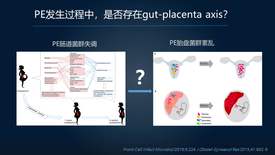 疾病|周宏伟：面对高致命孕期疾病，我们如何在肠道找到突破口？