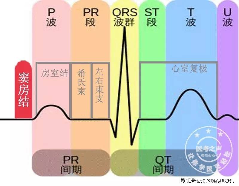 掌握这6项心电图干货,波形判断不再难!