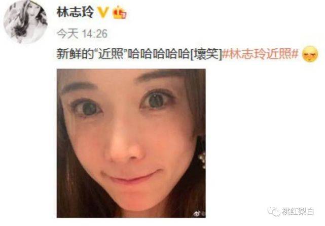 井柏然|明星红黑榜:婚后一年的林志玲,脸怎么肿成张萌了?