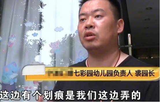 原创爸爸发现３岁孩子脸上流血，到幼儿园调视频观看后，怒而索赔32万