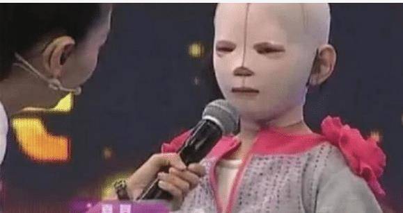 原创女孩因为一直戴头套上学，被同学疯狂嘲笑，把头套摘下后大家都沉默了