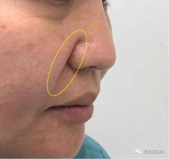 fa|杨紫do过头又翻车！剧抛脸全靠百万修图师？这是诈骗吧……