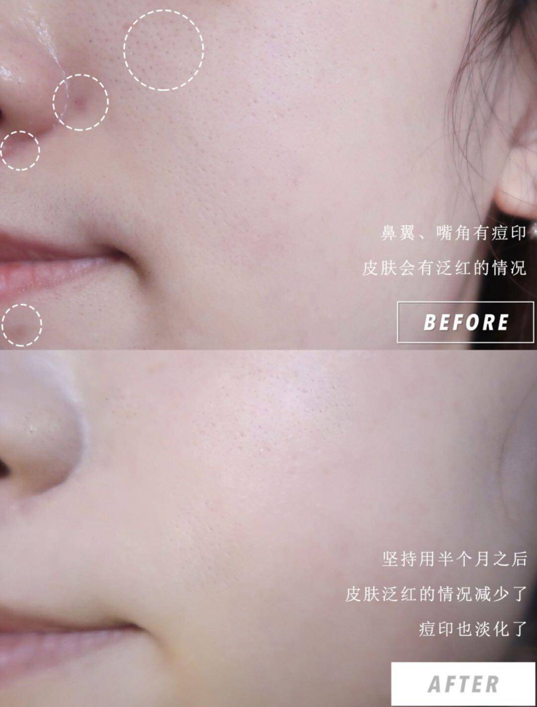 夏天|拒绝做天生“油”物，教你摆脱油腻带来的困扰吧