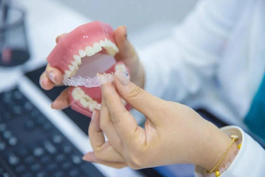 口腔|变美秘密！明星同款牙齿隐形矫正，隐适美暑期半价福利！