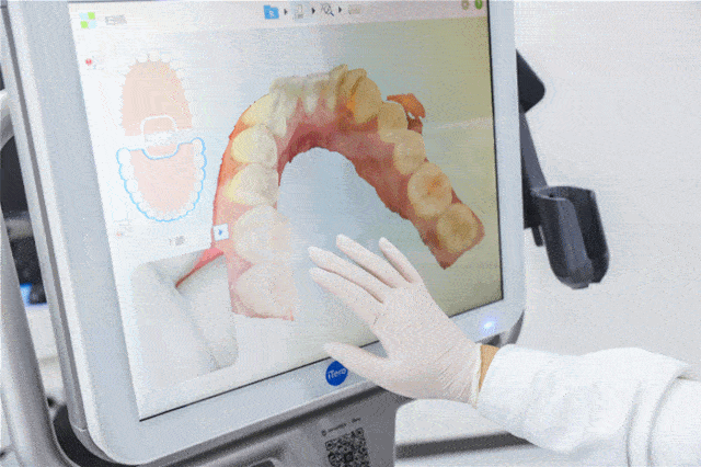 口腔|变美秘密！明星同款牙齿隐形矫正，隐适美暑期半价福利！