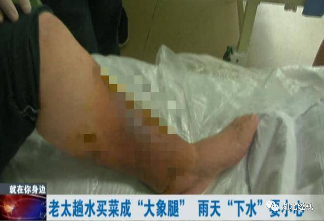 近期高发！雨天出门买菜，竟然