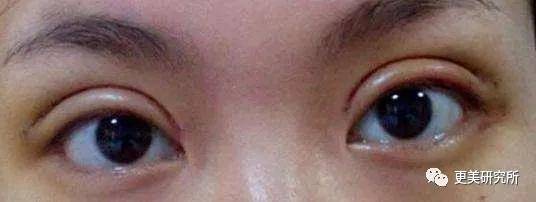 双眼皮|翻了100张照片，才发现她是贵圈换头最失败的女星