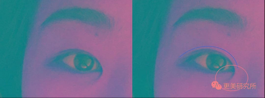 双眼皮|翻了100张照片，才发现她是贵圈换头最失败的女星