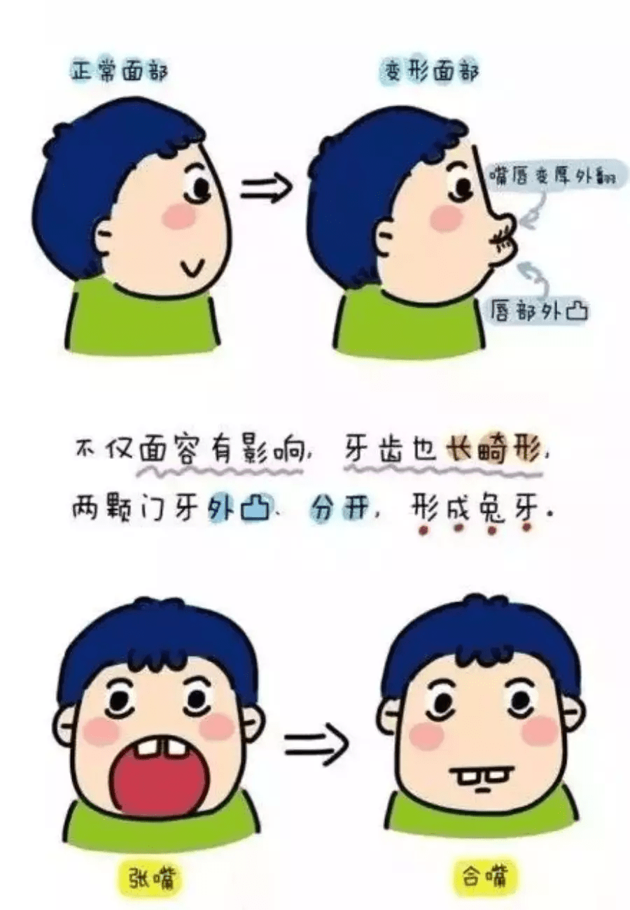 成语什么补鼻_成语故事图片(3)