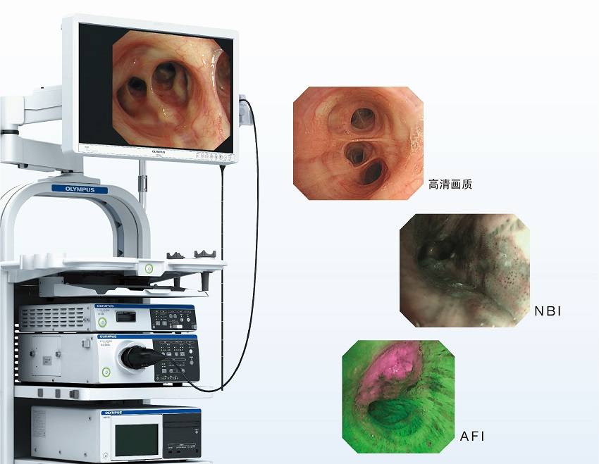洞察肺内病情利器 揭秘奥林巴斯电子支气管镜