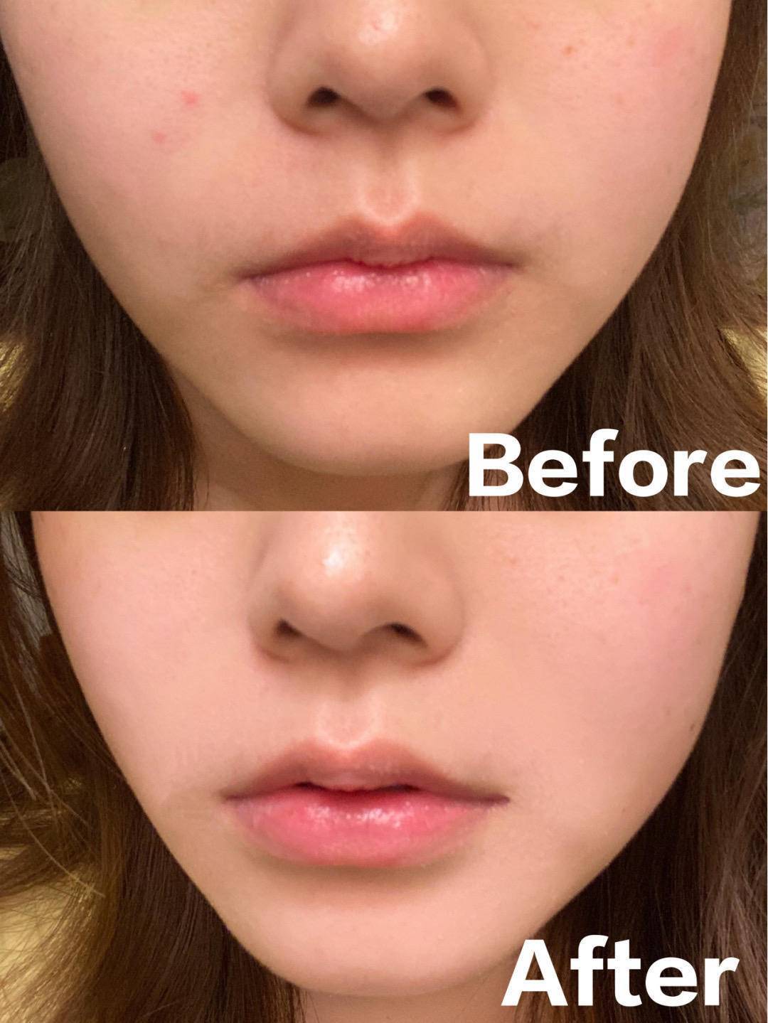 肌肤|不要被美白冲昏了头，夏季才是稳固年轻态的制胜关键