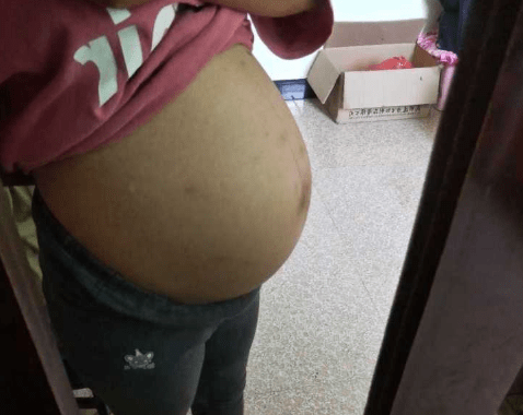 “早孕b超和阴超，有什么差异？”这一信号孕妈妈要警惕
