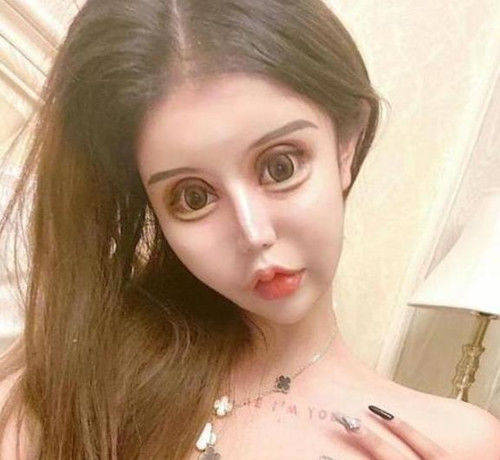 母亲|当年为整容花费百万，声称母亲支持的少女，如今容貌让人看了不适