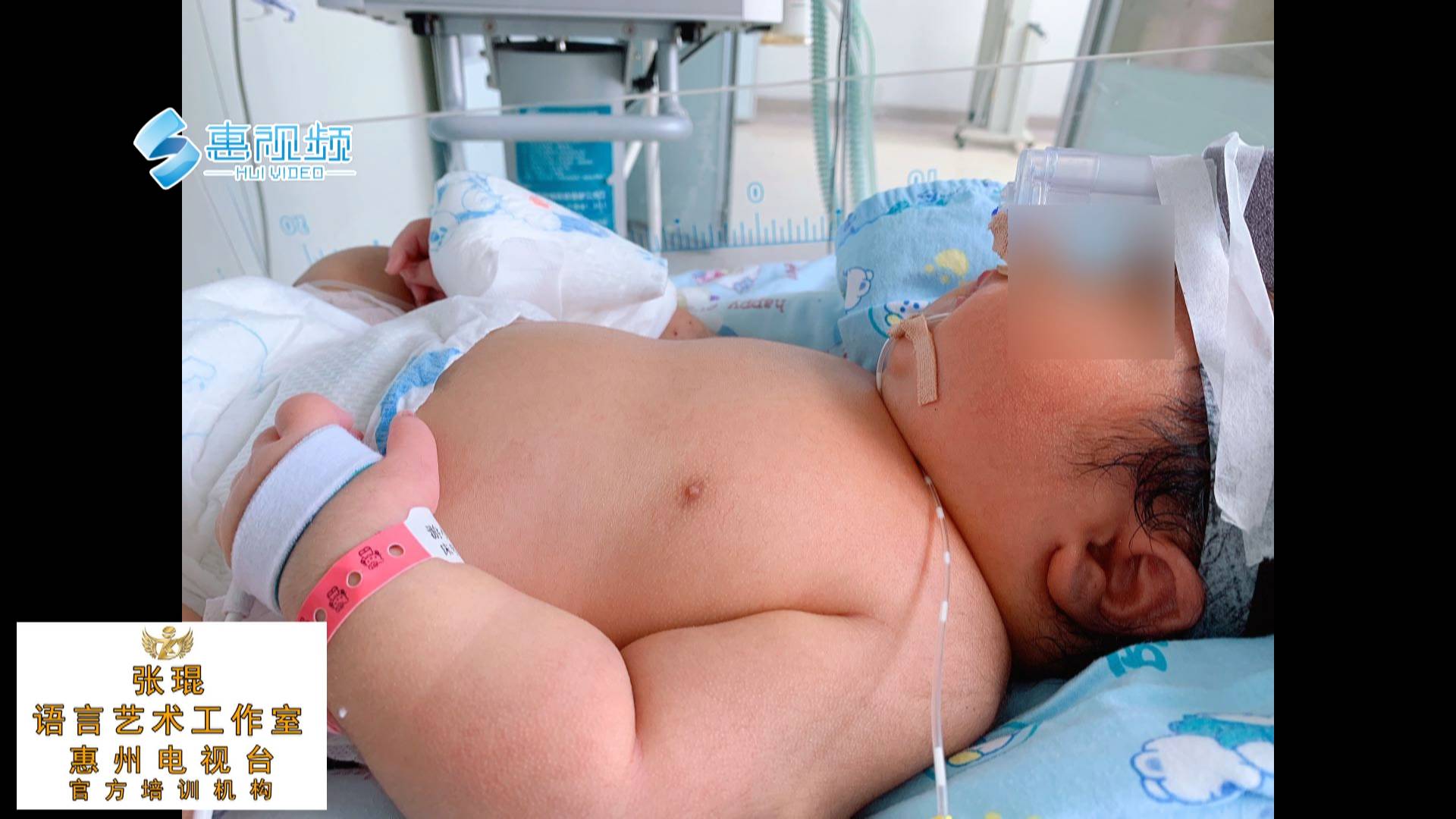 刚出生的宝宝溶血病很常见，溶血病存在什么症状？