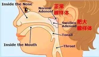 宝宝|这样做减轻孩子痛苦孩子睡觉有这个表现一定要注意！严重会影响智力发育