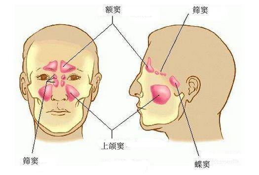 3,合并感染则鼻腔囊肿迅速增大,局部疼痛明显也是鼻前庭囊肿危害.