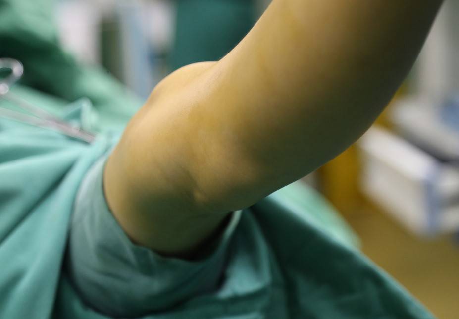 驻马店七岁儿童关节镜微创治疗腘窝囊肿手术