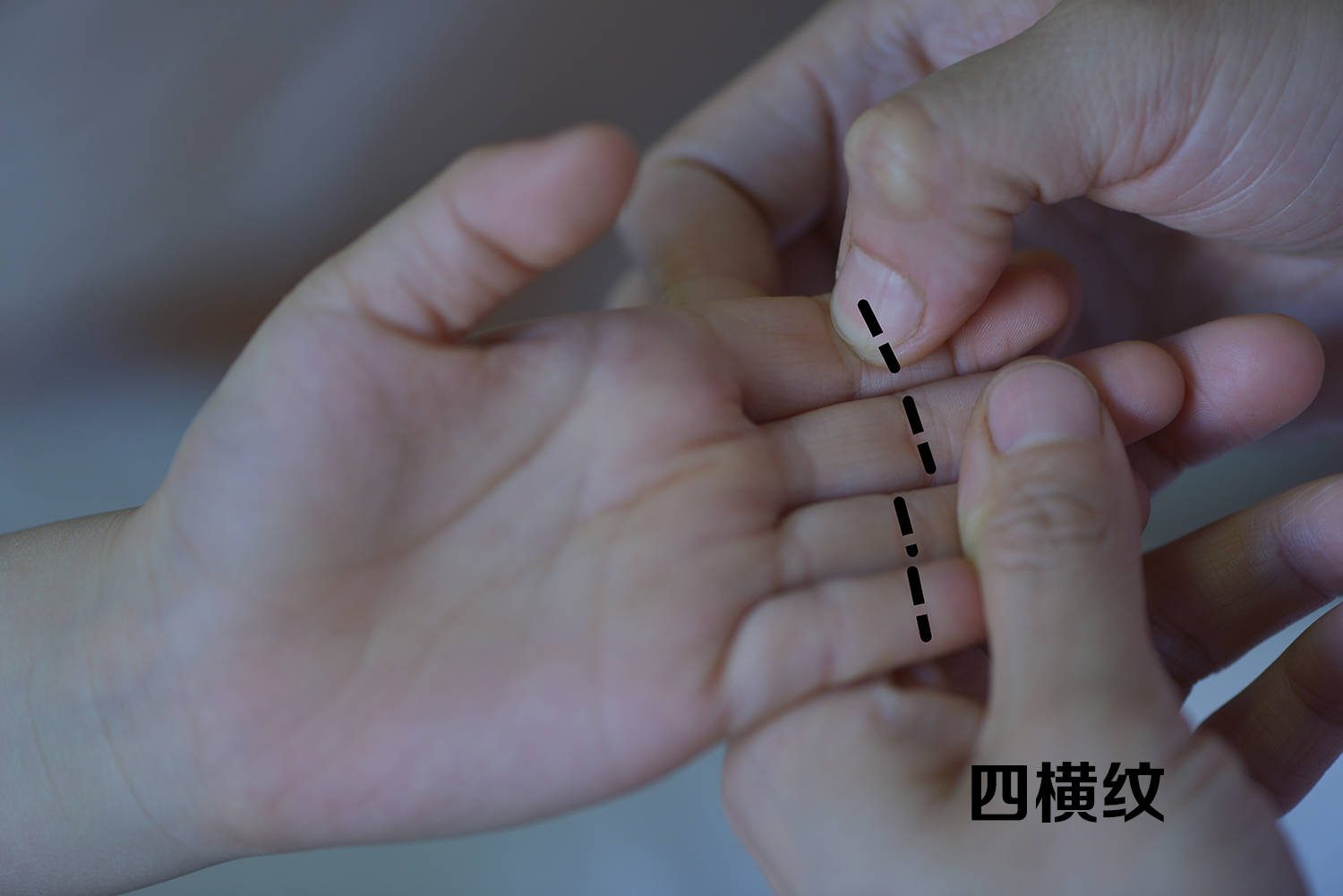 推拿|怎么判断宝宝到底有没有疳积？七仔妈小儿推拿